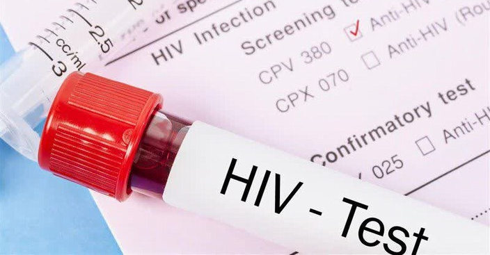 بیماری HIV